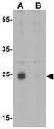 Homeobox protein Nkx-2.8 antibody, GTX31471, GeneTex, Western Blot image 