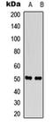 Solute Carrier Family 38 Member 2 antibody, orb315705, Biorbyt, Western Blot image 