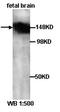 Leptin Receptor antibody, orb77157, Biorbyt, Western Blot image 