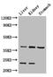 Aldo-Keto Reductase Family 1 Member A1 antibody, LS-C498341, Lifespan Biosciences, Western Blot image 