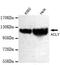 ATP Citrate Lyase antibody, GTX49218, GeneTex, Western Blot image 