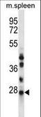 N-Ribosyldihydronicotinamide:Quinone Reductase 2 antibody, LS-C162980, Lifespan Biosciences, Western Blot image 
