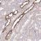 5'-Nucleotidase, Cytosolic IA antibody, NBP2-48604, Novus Biologicals, Immunohistochemistry paraffin image 
