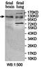 Protein SZT2 antibody, orb78209, Biorbyt, Western Blot image 
