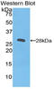 Integrin Subunit Beta 2 antibody, LS-C294697, Lifespan Biosciences, Western Blot image 