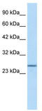 SRY-Box 14 antibody, TA339088, Origene, Western Blot image 