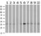 Nitrilase 1 antibody, M09715, Boster Biological Technology, Western Blot image 