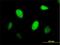 Centromere Protein J antibody, H00055835-B01P, Novus Biologicals, Immunofluorescence image 