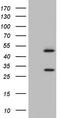 Nuclear Receptor Subfamily 1 Group I Member 3 antibody, CF805204, Origene, Western Blot image 