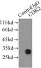 Cyclin Dependent Kinase 2 antibody, FNab01553, FineTest, Immunoprecipitation image 