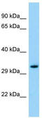 Olfactory Receptor Family 3 Subfamily A Member 1 antibody, TA332126, Origene, Western Blot image 