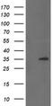 Zinc Finger C2HC-Type Containing 1A antibody, M16796, Boster Biological Technology, Western Blot image 