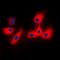 Cytochrome P450 Family 2 Subfamily A Member 6 antibody, orb216084, Biorbyt, Immunofluorescence image 