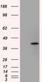 Sterol O-acyltransferase 2 antibody, CF501224, Origene, Western Blot image 