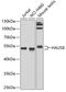 HAUS augmin-like complex subunit 8 antibody, A12994-1, Boster Biological Technology, Western Blot image 