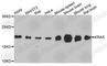 KRAS Proto-Oncogene, GTPase antibody, A1190, ABclonal Technology, Western Blot image 