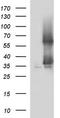 Secretory Carrier Membrane Protein 2 antibody, LS-C338307, Lifespan Biosciences, Western Blot image 