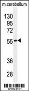 Divergent Protein Kinase Domain 1B antibody, 55-754, ProSci, Western Blot image 