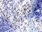 Neutrophil gelatinase-associated lipocalin antibody, PB9609, Boster Biological Technology, Immunohistochemistry paraffin image 
