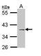 Melanocyte-stimulating hormone receptor antibody, orb74034, Biorbyt, Western Blot image 