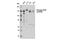 Unc-51 Like Autophagy Activating Kinase 1 antibody, 14205S, Cell Signaling Technology, Western Blot image 