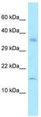 Ribosomal Protein L36a antibody, TA338016, Origene, Western Blot image 
