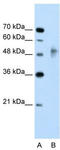 RING finger protein 38 antibody, TA330460, Origene, Western Blot image 