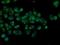 Mitochondrial Translational Release Factor 1 Like antibody, NBP2-02384, Novus Biologicals, Immunocytochemistry image 