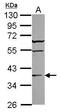 ST6 N-Acetylgalactosaminide Alpha-2,6-Sialyltransferase 2 antibody, PA5-31353, Invitrogen Antibodies, Western Blot image 