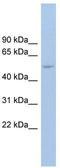 Ankyrin Repeat Domain 13D antibody, TA335106, Origene, Western Blot image 