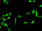 Phosphoglycerate Dehydrogenase antibody, LS-B5457, Lifespan Biosciences, Immunofluorescence image 