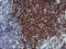 CD22 Molecule antibody, LS-C174778, Lifespan Biosciences, Immunohistochemistry paraffin image 