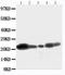 Caveolin 1 antibody, LS-C312673, Lifespan Biosciences, Western Blot image 