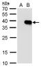 Homeobox protein Hox-A5 antibody, GTX129211, GeneTex, Western Blot image 