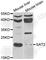 Diamine acetyltransferase 2 antibody, A7211, ABclonal Technology, Western Blot image 