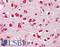 LIMP II antibody, LS-B8307, Lifespan Biosciences, Immunohistochemistry paraffin image 