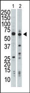 Nuclear Receptor Binding Protein 1 antibody, AP15034PU-N, Origene, Western Blot image 