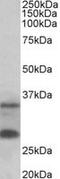 U6 snRNA phosphodiesterase antibody, MBS422774, MyBioSource, Western Blot image 