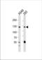 hSIRT1 antibody, TA328121, Origene, Western Blot image 