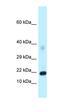 Formimidoyltransferase Cyclodeaminase antibody, orb330194, Biorbyt, Western Blot image 