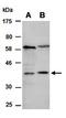 PDGFB antibody, orb67020, Biorbyt, Western Blot image 