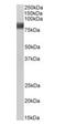 Src substrate protein p85 antibody, orb18335, Biorbyt, Western Blot image 