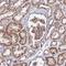 Zinc Finger CCCH-Type Containing 10 antibody, HPA039236, Atlas Antibodies, Immunohistochemistry paraffin image 