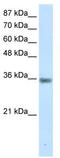 CDK-activating kinase assembly factor MAT1 antibody, TA335831, Origene, Western Blot image 
