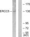 DNA repair protein complementing XP-G cells antibody, abx013453, Abbexa, Western Blot image 