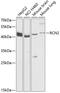 Reticulocalbin 2 antibody, GTX66107, GeneTex, Western Blot image 