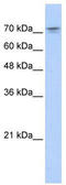 NF-kappa-B-repressing factor antibody, TA339497, Origene, Western Blot image 