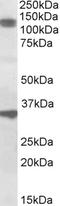 Cell Division Cycle And Apoptosis Regulator 1 antibody, EB09758, Everest Biotech, Western Blot image 