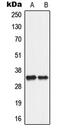 Solute Carrier Family 25 Member 5 antibody, MBS820539, MyBioSource, Western Blot image 