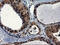 CCR4-NOT Transcription Complex Subunit 4 antibody, M08405-2, Boster Biological Technology, Immunohistochemistry paraffin image 
